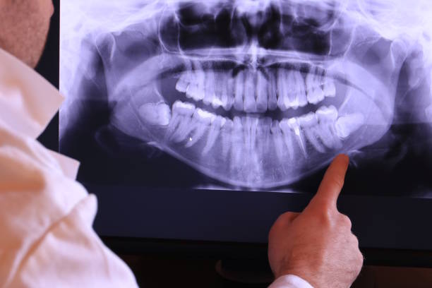 Best Emergency Treatment for Toothache in Harrisville, UT